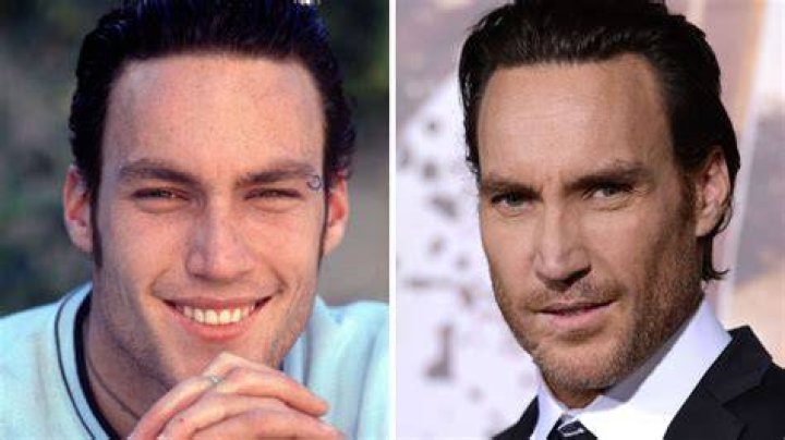 Callan Mulvey de Hartley, cœurs à vif se confie sur son accident Elle
